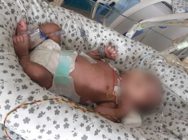 18 Days Old Son Of Surjit Needs Your Help Recover From  Infant Respiratory Distress Syndrome