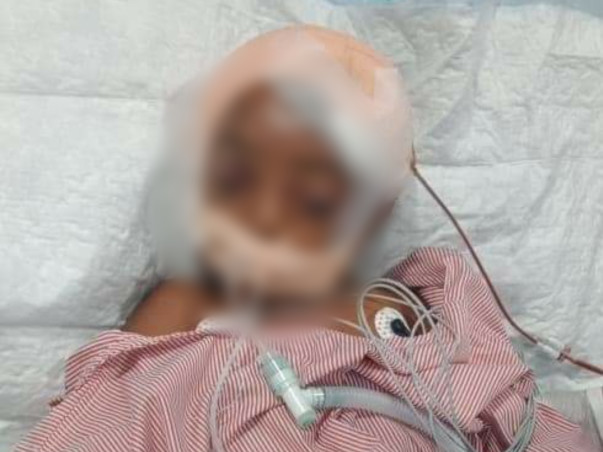 Save This Poor Family Who Met With An Severe Accident