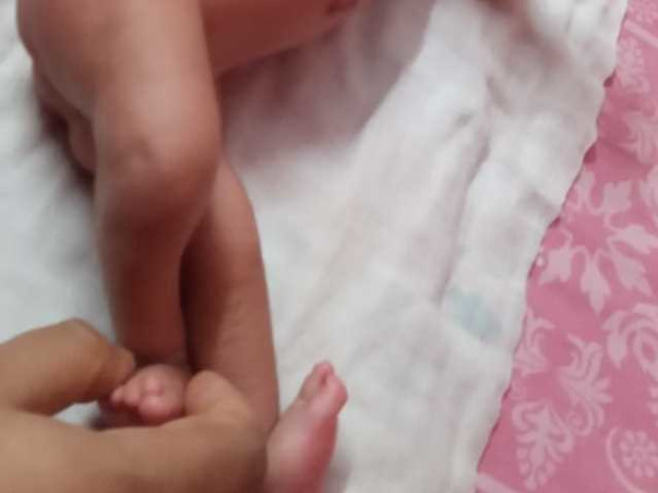 1 month old Aahan Needs Your Help Fight Arthrogryposis Multiplex Congenita
