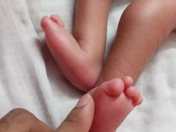 1 month old Aahan Needs Your Help Fight Arthrogryposis Multiplex Congenita