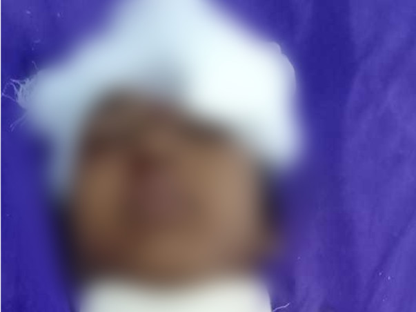 Help My Daughter Pratiskha Recover From Severe Head Injury Accident