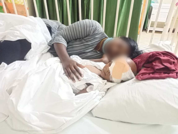 Help Gowtham Sai Eye Bilateral Retiblastoma