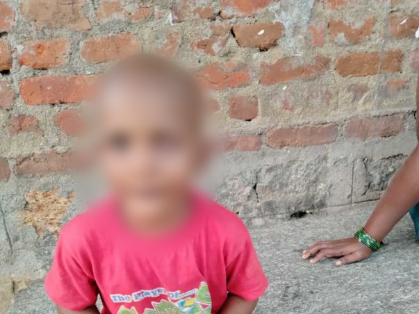 Help Gowtham Sai Eye Bilateral Retiblastoma