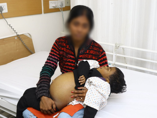 Help My Daughter Undergo Liver Transplant