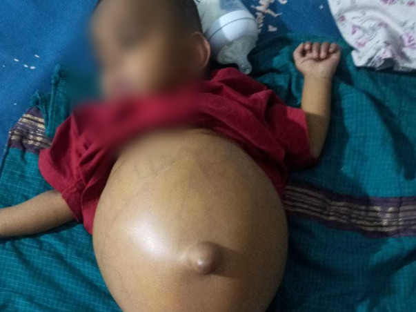 My Son Needs Urgent Liver Transplantation Please do Help Me