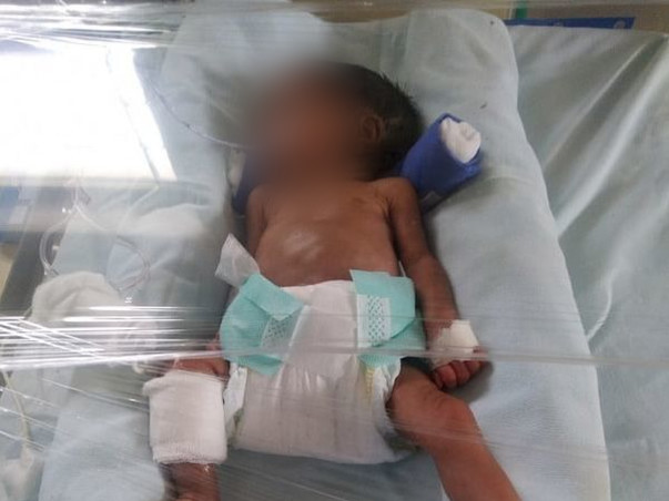1 Month Old Baby Of Shubhagi Needs Your Help Recover From Prematurity