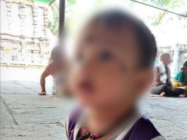 11 months old Lakshmi Chetan needs your help fight Head injury