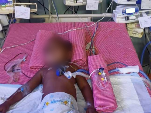 3 years old Himavardhan needs your help fight Traumatic brain injury