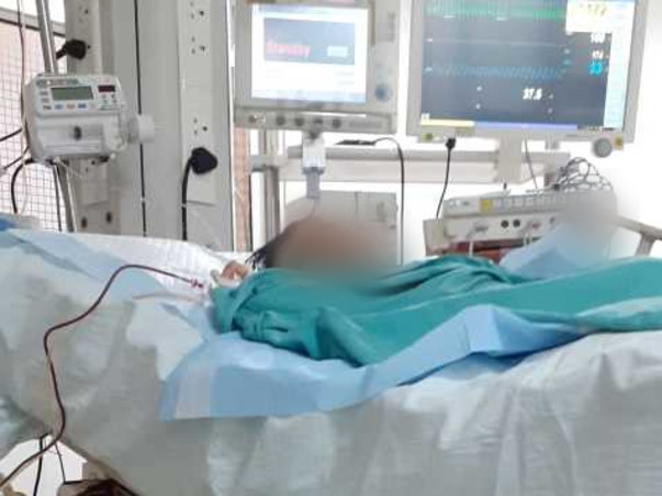 Congenital protein C Defiency -Rare Genetic  Disorder