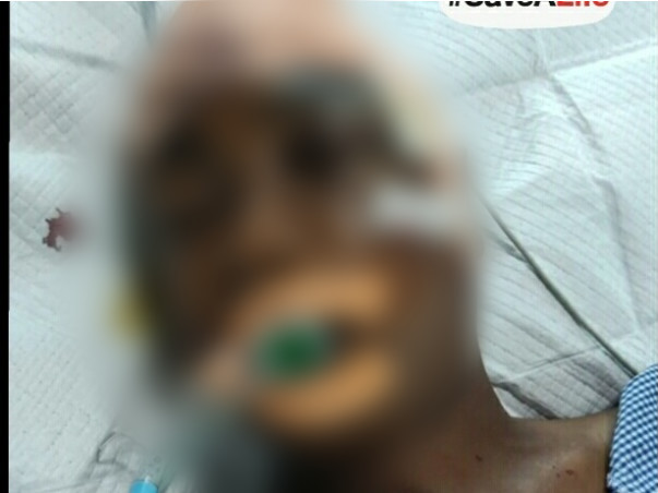 Help my brother fight critical brain and spain surgeries... Help him for next chance for life