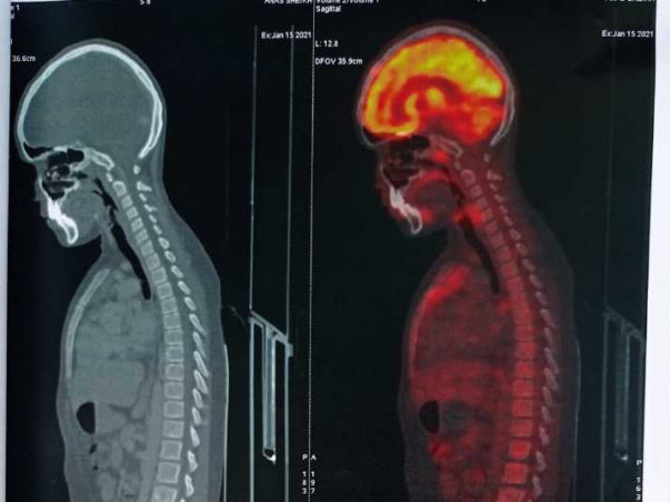 Help My Son Anas Sheikh Recover From Lymphoma Cancer