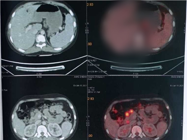 Help My Son Anas Sheikh Recover From Lymphoma Cancer