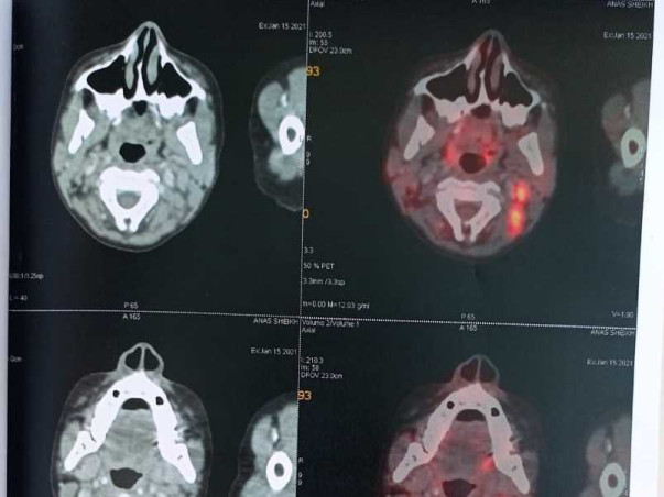 Help My Son Anas Sheikh Recover From Lymphoma Cancer