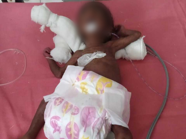 Support Divya For Her Premature Baby To Recover.