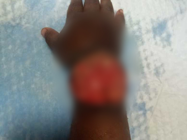 3-Years-Old Athvik Needs Your Help Fight Leukaemia Blood Cancer