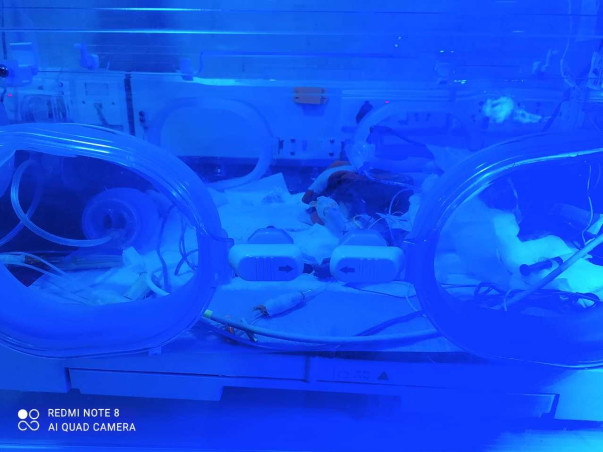 SUPPORT NANDINI TO SAVE HER PREMATURE BABY