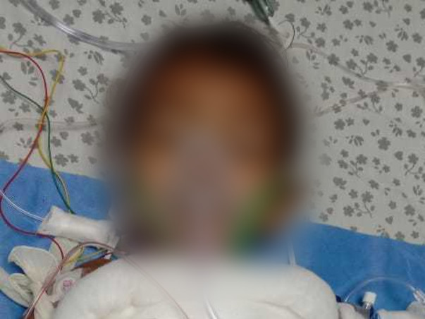 Support My Daughter To Recover From Hot Water Burns