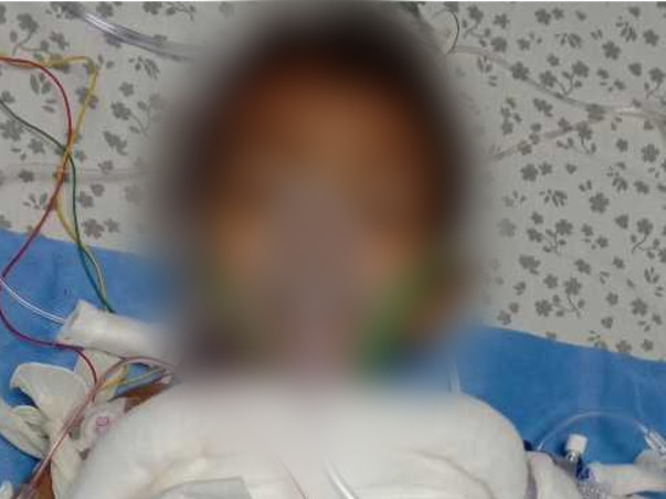 Support My Daughter To Recover From Hot Water Burns