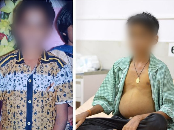 16 Years Old Darshan Gurushantappa Needs Your Help Fight Decompensated Liver Disease