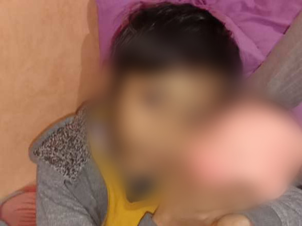 Funds for little Mahi's Speech Therapy and  Cochlear Implant Surgery