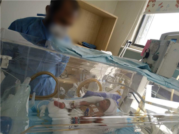 Premature Baby Needs Prolonged NICU To Survive