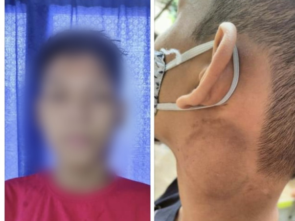 Help 16-Year-Old Boy Fight With Cancer