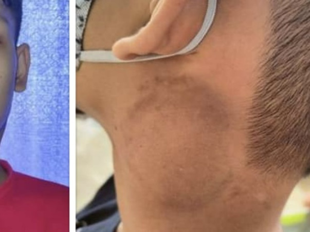 Help 16-Year-Old Boy Fight With Cancer