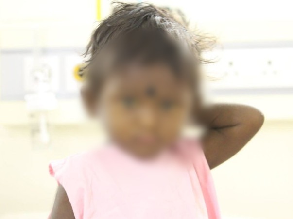 2-Year-Old With Swollen Belly Needs Urgent Liver Transplant To Survive