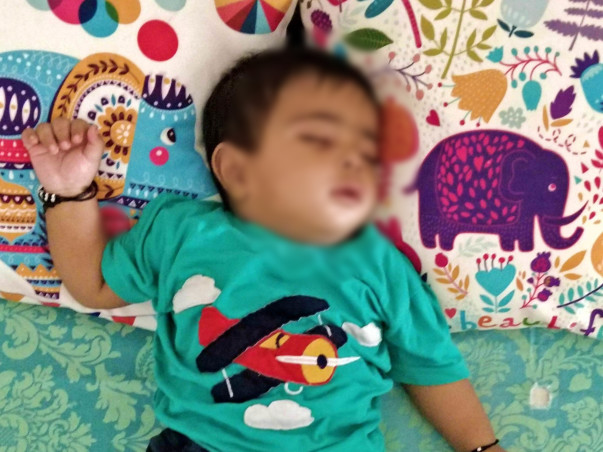 Help 7 Months Old Taimur, Recover Heart Disease (VSD) Faster