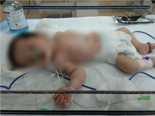 Support Baby Of Akhila To Recover From Msud Maple Syrup Urine Disease