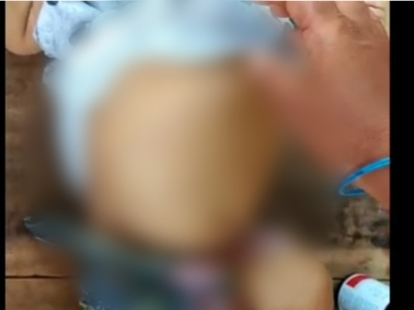 Save Nithiksha By Joining Yours Hands Plz Donate