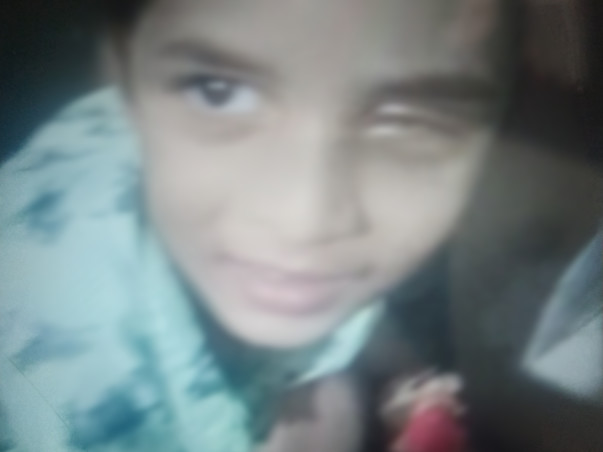 Support My Son To Undergo Eye Surgery