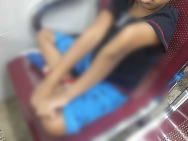 Support Sanjay Recover From Osteogenesis Imperfecta