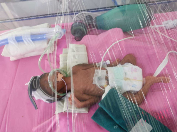 Please Help My Sister's Preterm Birth Twins Girl Babies