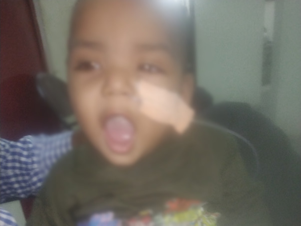 Support My 15 Months Old Child, Recover From Brain Disease.