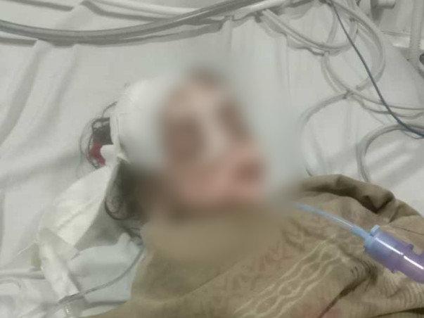 Help Needed For 3 Years Old Kavya. Please Save Her