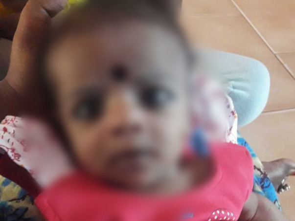 Help My Daughter to Recover From Anomalous Pulmonary Venous Connection