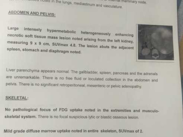 Support Ranesh Krishna Recover From Kidney Tumour