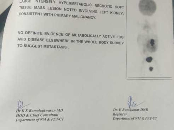 Support Ranesh Krishna Recover From Kidney Tumour