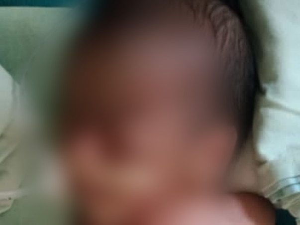 5 Days Old Baby Of Saswoti Needs Your Help Fight Multiple Diseases