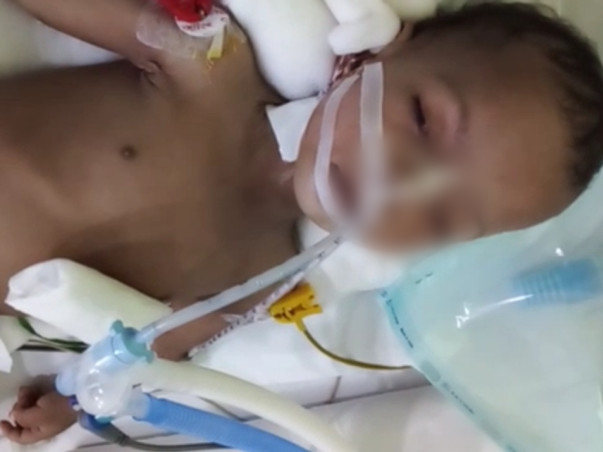 My Son Is Struggling With Dilated Cardiomyopathy, Help Him