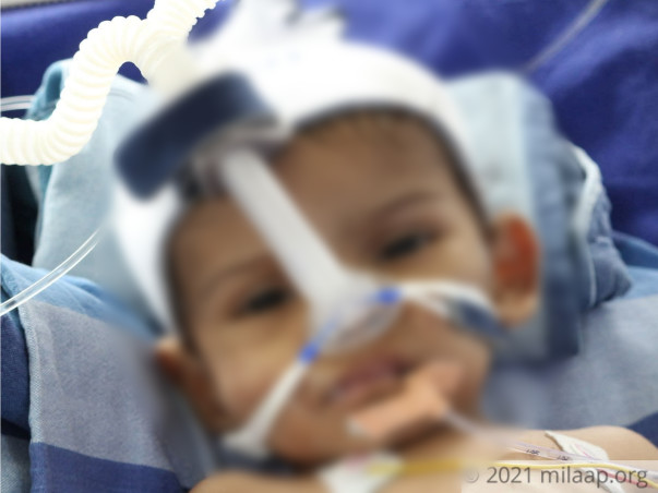 9-Month-Baby With 2 Holes In His Heart Needs Your Help To Live