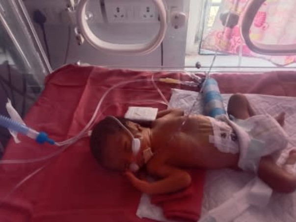 Help Triplet Babies Fight Pre Mature birth