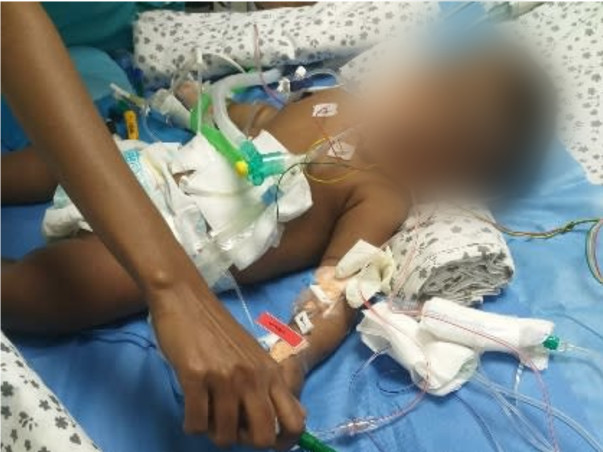 Help This Baby Get A Second chance at Life,He is Fighting for life