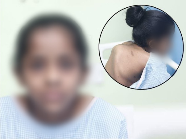 Help my daughter fight Hello traction And scoliosis correction