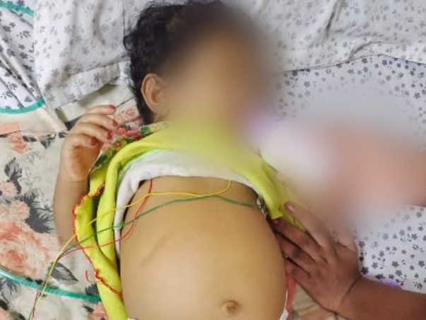 Support Aayat Unissa To Recover From Liver Damage