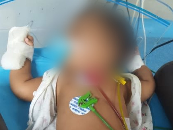 Support Koviniyan Recover From Propionic Acidemia