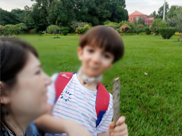 Help avyaan to remove his tracheostomy tube