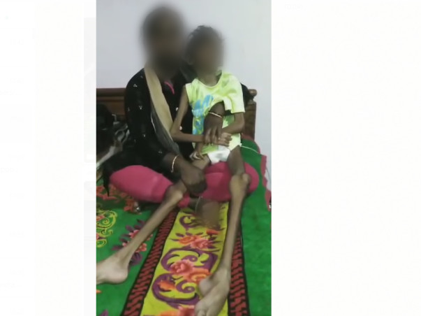 Please Save 8 Year Old Monica From More Suffering And Pain