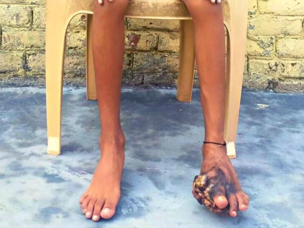 Help Golu Walk Again